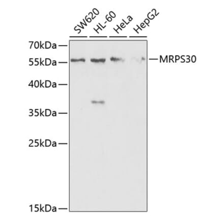 Western Blot - Anti-MRPS30 Antibody (A11887) - Antibodies.com