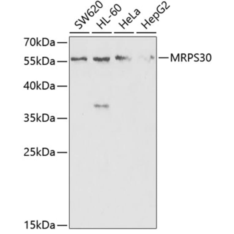 Western Blot - Anti-MRPS30 Antibody (A11887) - Antibodies.com