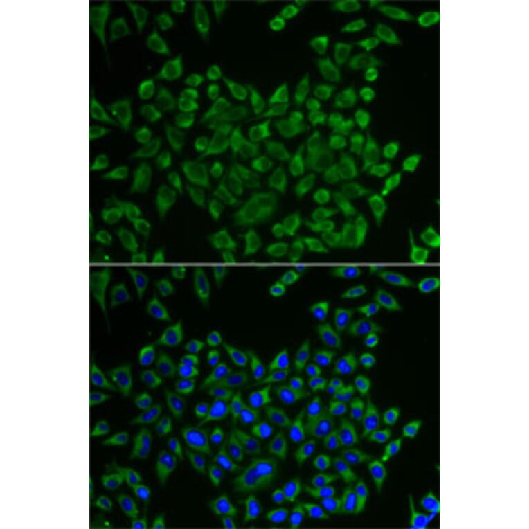 Immunofluorescence - Anti-MRPS30 Antibody (A11887) - Antibodies.com