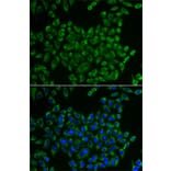 Immunofluorescence - Anti-MRPS30 Antibody (A11887) - Antibodies.com