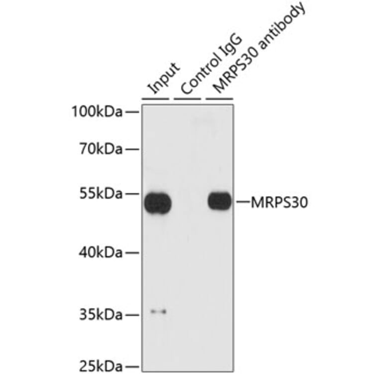 Western Blot - Anti-MRPS30 Antibody (A11887) - Antibodies.com