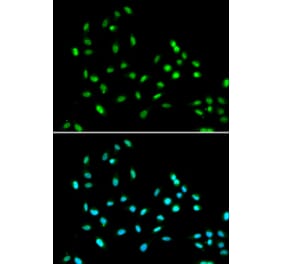 Immunofluorescence - Anti-SMARCAD1 Antibody (A11888) - Antibodies.com