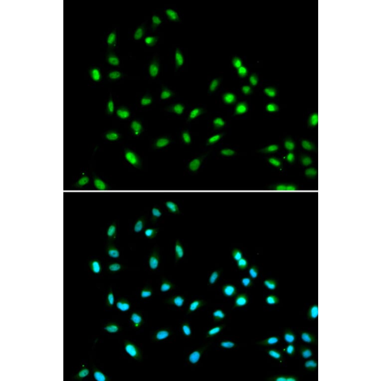 Immunofluorescence - Anti-SMARCAD1 Antibody (A11888) - Antibodies.com