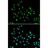 Immunofluorescence - Anti-SMARCAD1 Antibody (A11888) - Antibodies.com