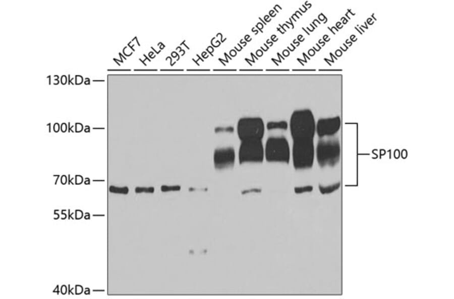 Anti-SP100 Antibody (A11889) | Antibodies.com