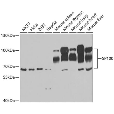 Western Blot - Anti-SP100 Antibody (A11889) - Antibodies.com