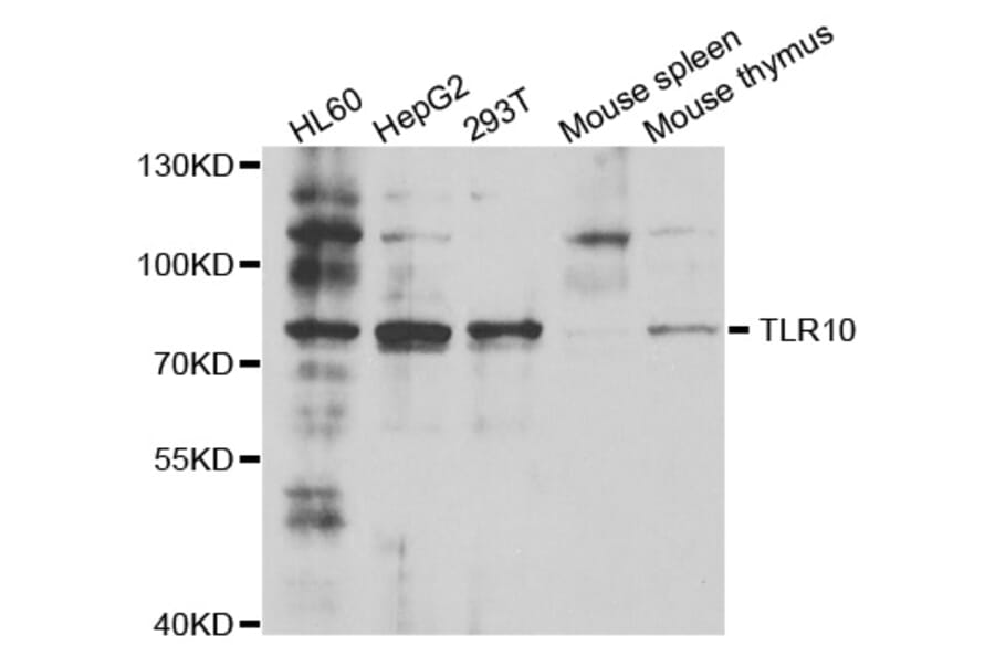 Western Blot - Anti-TLR10 Antibody (A5852) - Antibodies.com