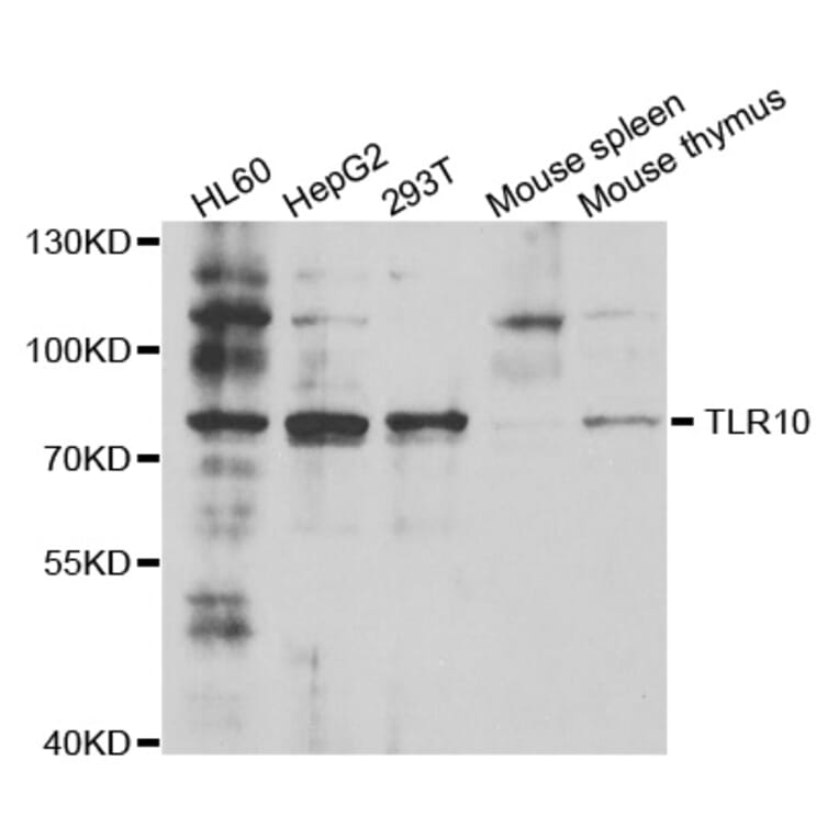 Western Blot - Anti-TLR10 Antibody (A5852) - Antibodies.com