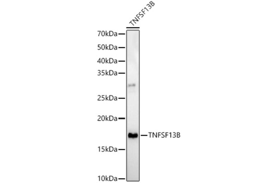 Western Blot - Anti-BAFF Antibody (A11891) - Antibodies.com