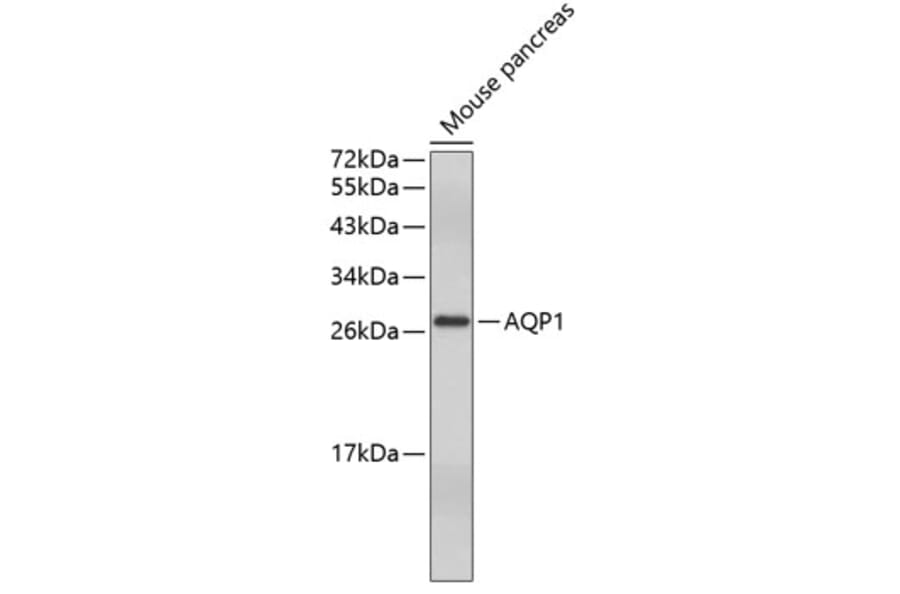 Western Blot - Anti-AQP1 Antibody (A5868) - Antibodies.com