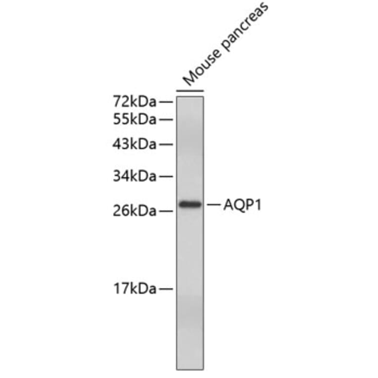 Western Blot - Anti-AQP1 Antibody (A5868) - Antibodies.com