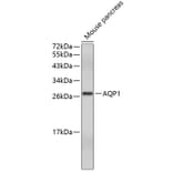 Western Blot - Anti-AQP1 Antibody (A5868) - Antibodies.com