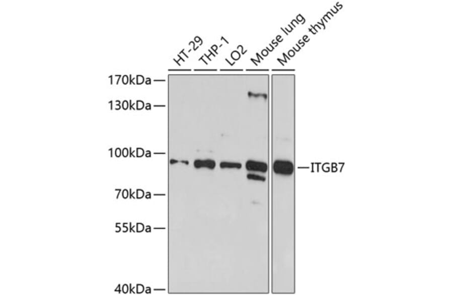 Western Blot - Anti-Integrin beta 7 Antibody (A11893) - Antibodies.com