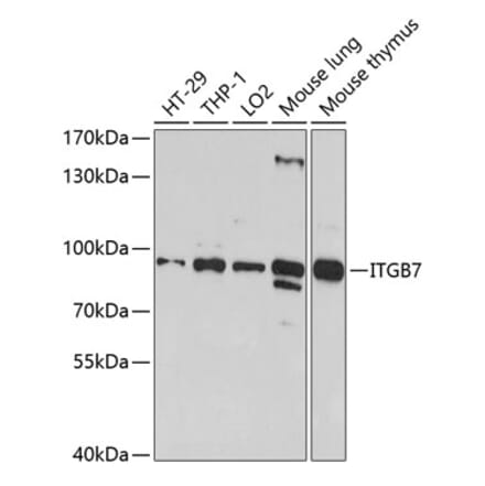 Western Blot - Anti-Integrin beta 7 Antibody (A11893) - Antibodies.com