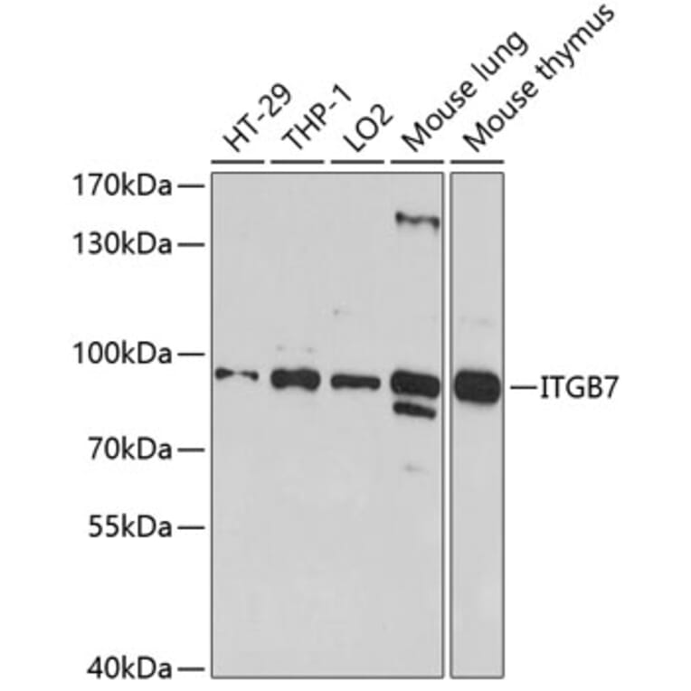 Western Blot - Anti-Integrin beta 7 Antibody (A11893) - Antibodies.com