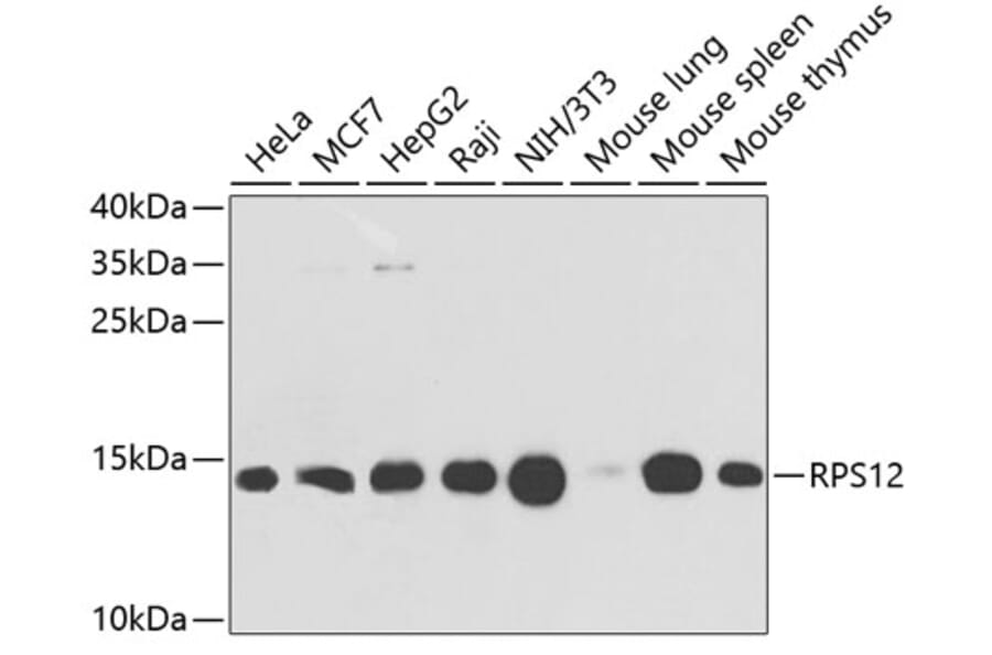 Western Blot - Anti-RPS12 Antibody (A11894) - Antibodies.com