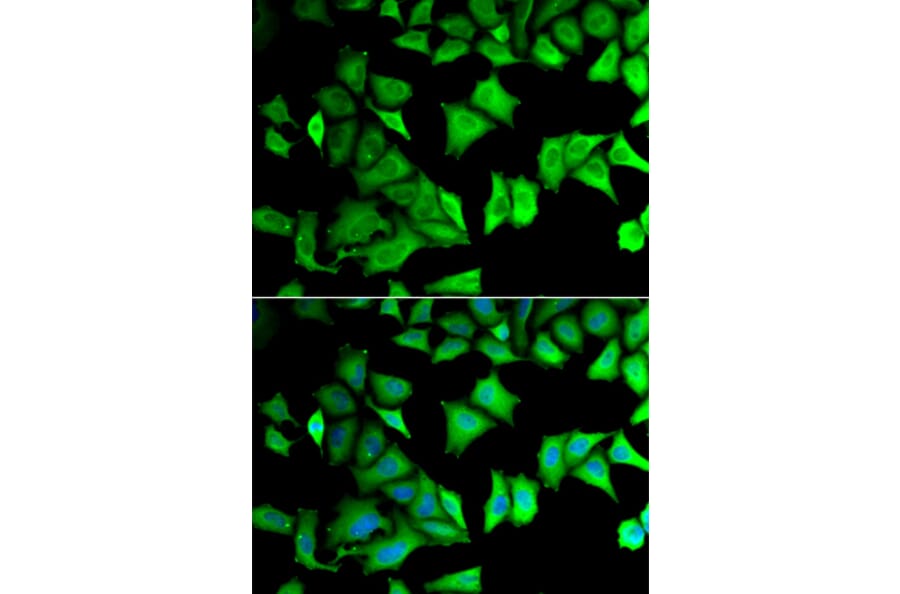 Immunofluorescence - Anti-RPS12 Antibody (A11894) - Antibodies.com
