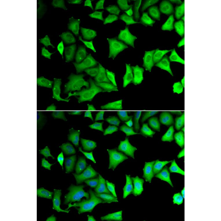 Immunofluorescence - Anti-RPS12 Antibody (A11894) - Antibodies.com