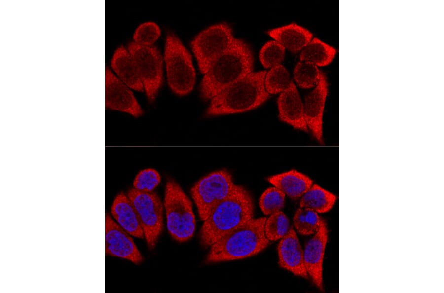 Immunofluorescence - Anti-RPS12 Antibody (A11894) - Antibodies.com