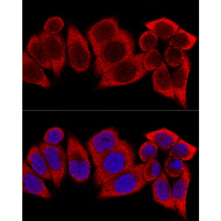 Immunofluorescence - Anti-RPS12 Antibody (A11894) - Antibodies.com