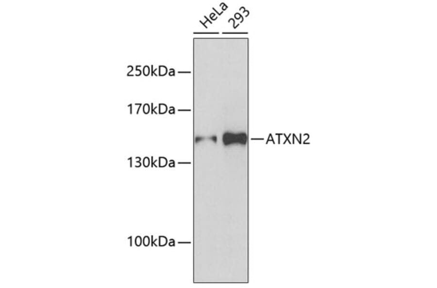 Western Blot - Anti-ATXN2 Antibody (A5902) - Antibodies.com