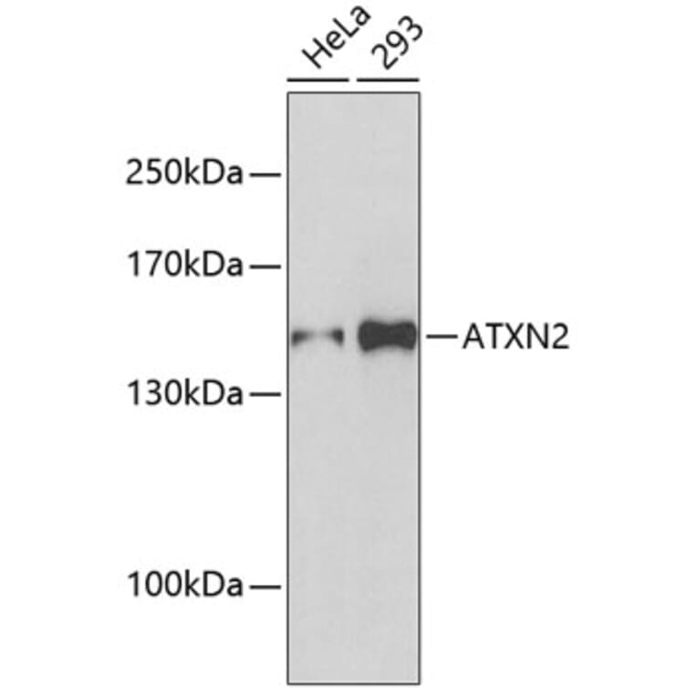 Western Blot - Anti-ATXN2 Antibody (A5902) - Antibodies.com