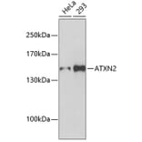 Western Blot - Anti-ATXN2 Antibody (A5902) - Antibodies.com