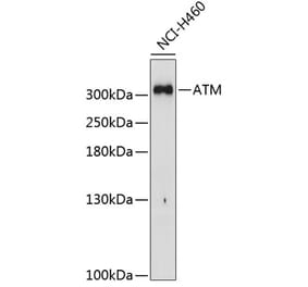 Western Blot - Anti-ATM Antibody (A11896) - Antibodies.com
