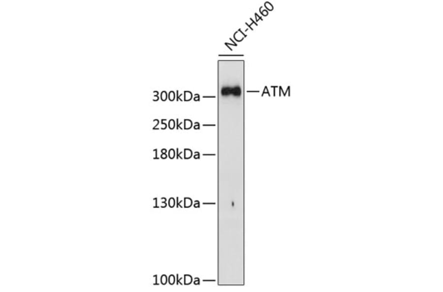 Western Blot - Anti-ATM Antibody (A11896) - Antibodies.com