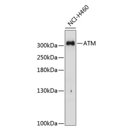 Western Blot - Anti-ATM Antibody (A11896) - Antibodies.com