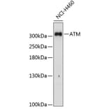 Western Blot - Anti-ATM Antibody (A11896) - Antibodies.com