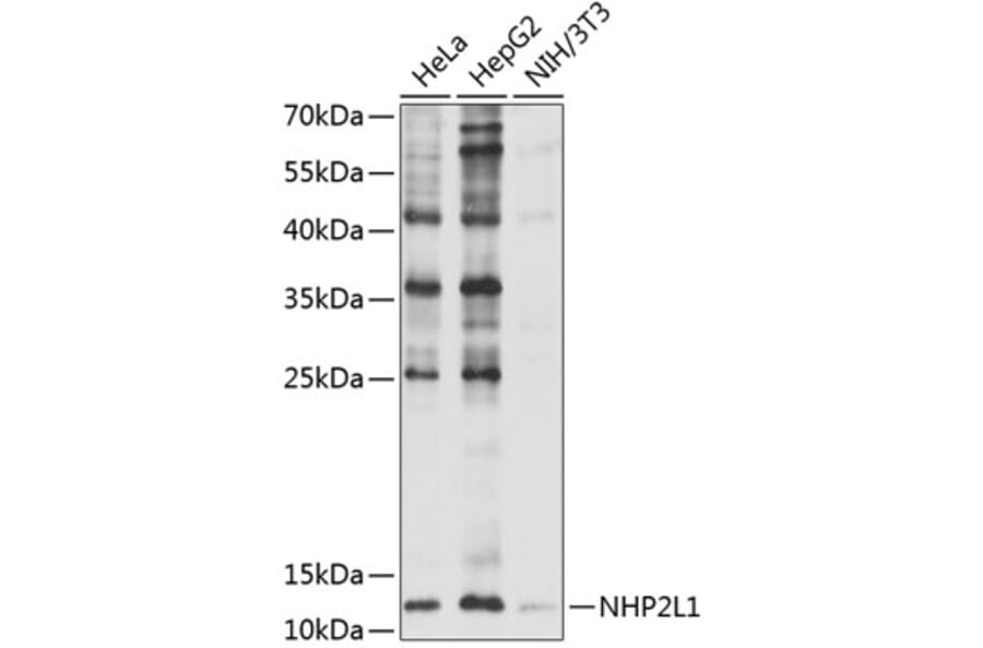 Western Blot - Anti-NHP2L1 Antibody (A11897) - Antibodies.com