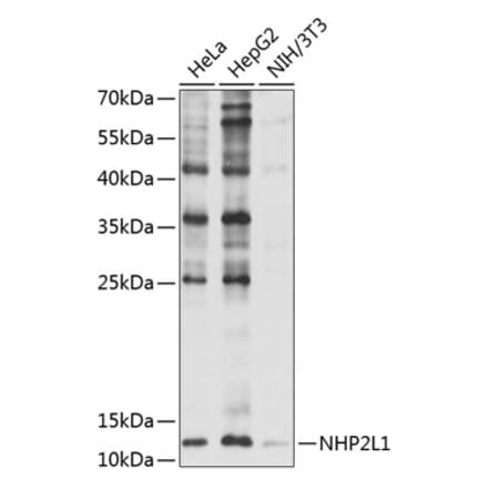 Western Blot - Anti-NHP2L1 Antibody (A11897) - Antibodies.com