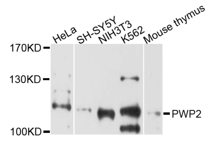 Western Blot - Anti-PWP2 Antibody (A5929) - Antibodies.com