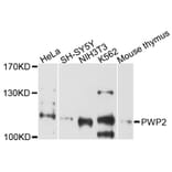 Western Blot - Anti-PWP2 Antibody (A5929) - Antibodies.com