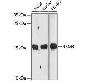 Western Blot - Anti-RBM3 Antibody (A11899) - Antibodies.com