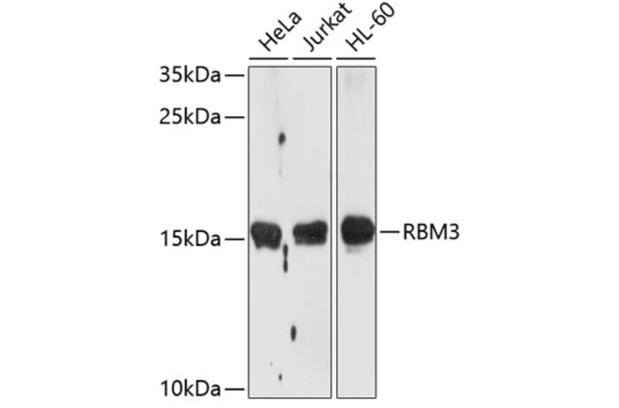 Western Blot - Anti-RBM3 Antibody (A11899) - Antibodies.com