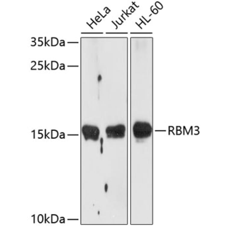 Western Blot - Anti-RBM3 Antibody (A11899) - Antibodies.com