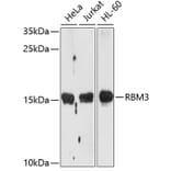 Western Blot - Anti-RBM3 Antibody (A11899) - Antibodies.com