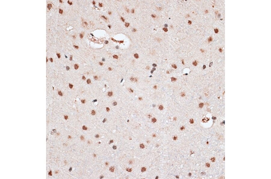 Immunohistochemistry - Anti-RBM3 Antibody (A11899) - Antibodies.com