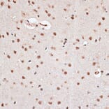 Immunohistochemistry - Anti-RBM3 Antibody (A11899) - Antibodies.com