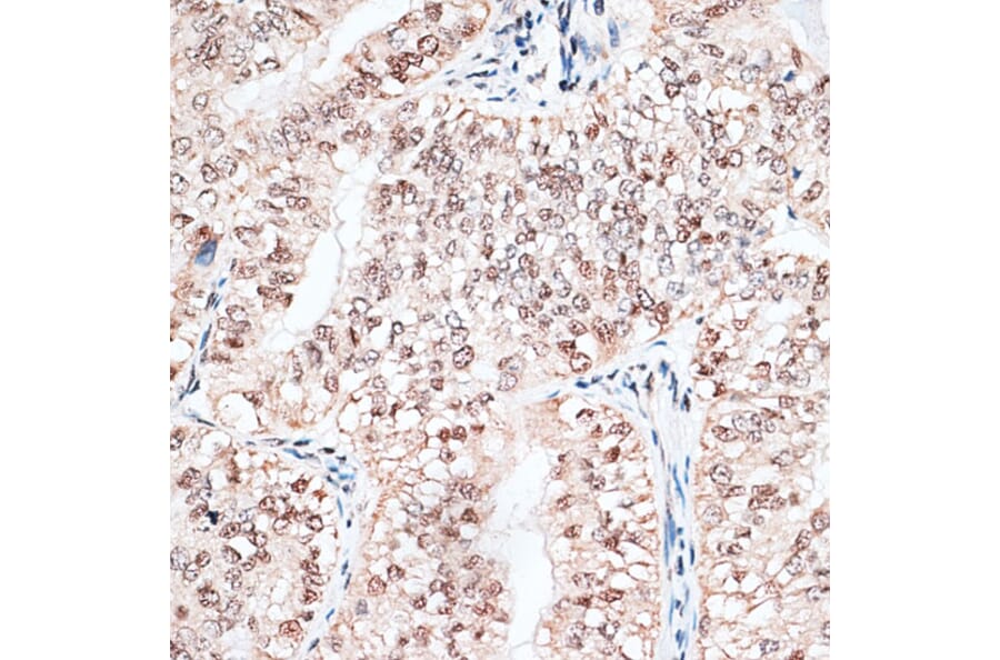 Immunohistochemistry - Anti-RBM3 Antibody (A11899) - Antibodies.com