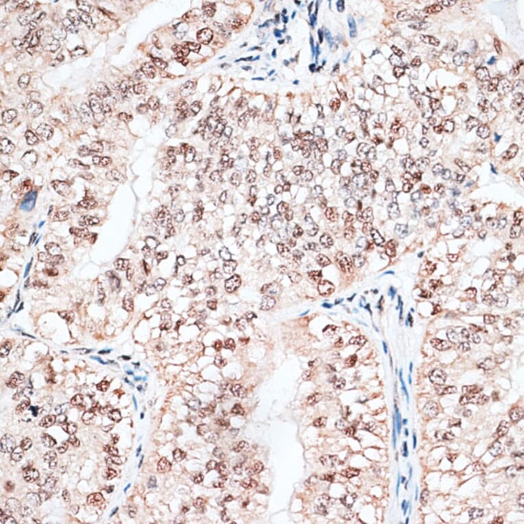 Immunohistochemistry - Anti-RBM3 Antibody (A11899) - Antibodies.com