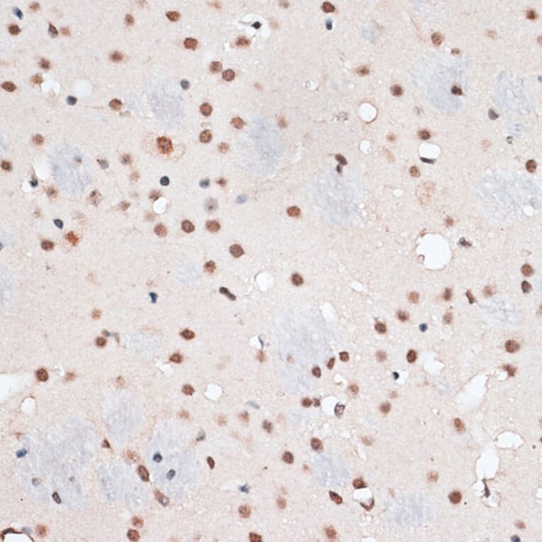 Immunohistochemistry - Anti-RBM3 Antibody (A11899) - Antibodies.com