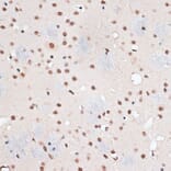 Immunohistochemistry - Anti-RBM3 Antibody (A11899) - Antibodies.com