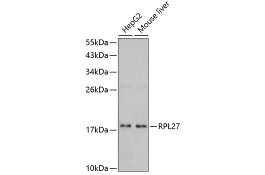 Western Blot - Anti-RPL27 Antibody (A5936) - Antibodies.com
