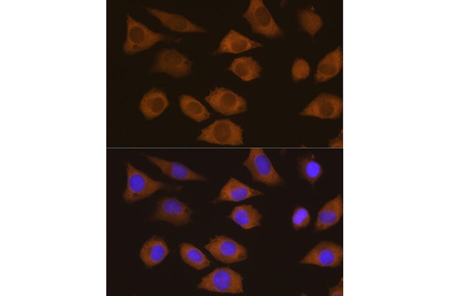 Immunofluorescence - Anti-CSDE1/NRU Antibody (A11901) - Antibodies.com