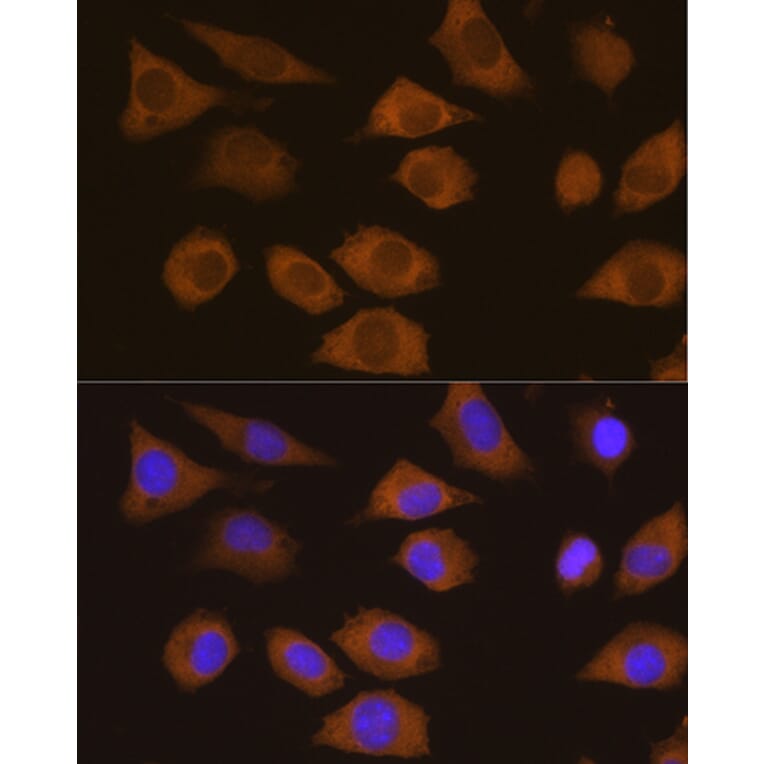 Immunofluorescence - Anti-CSDE1/NRU Antibody (A11901) - Antibodies.com