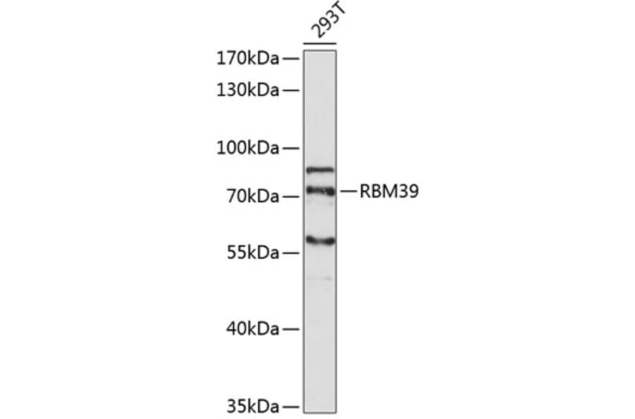 Western Blot - Anti-RBM39 Antibody (A5950) - Antibodies.com
