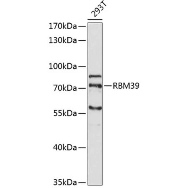 Western Blot - Anti-RBM39 Antibody (A5950) - Antibodies.com